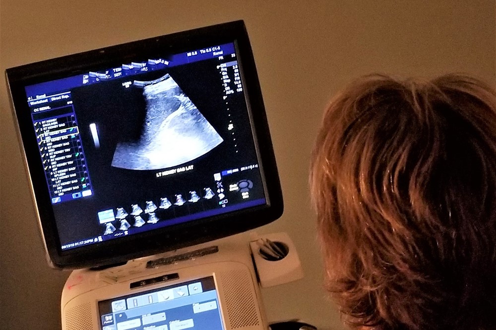  Ledviny jsou životně důležité pro naše každodenní zdraví a existuje mnoho zdravotních problémů, které přispívají k chronickému onemocnění ledvin. 